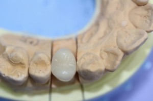 treatment_img017