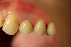 treatment_img018